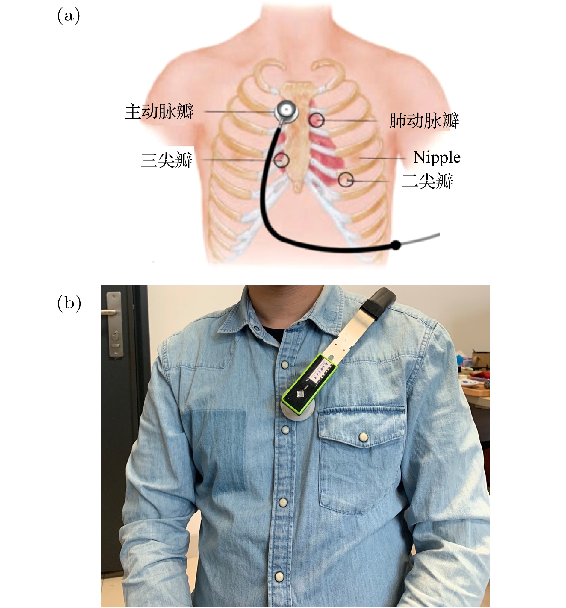 肺部听诊位置及顺序图图片