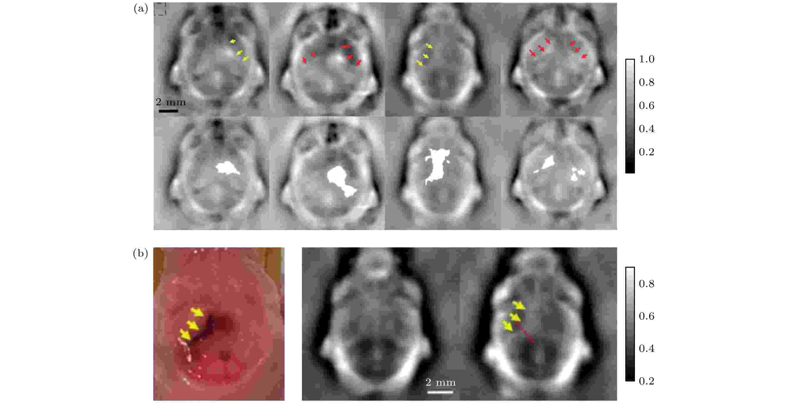 Biomedical microwave-induced thermoacoustic imaging Biomedical microwave-induced thermoacoustic imaging
